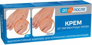 До И После крем против пигментных пятен 50мл Твинс Тэк До И После крем против пигментных пятен 50мл Твинс Тэк