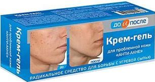 До И После крем-гель Анти-Акне 50мл Твинс Тэк До И После крем-гель Анти-Акне 50мл Твинс Тэк